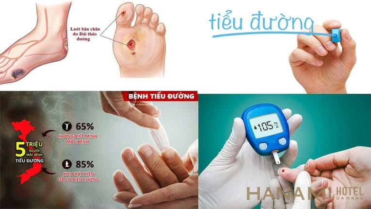 Bệnh tiểu đường là gì? Cách điều trị đái tháo đường