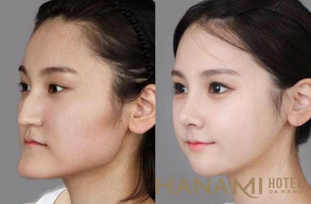 Lợi ích của việc làm đẹp tại thẩm mỹ viện