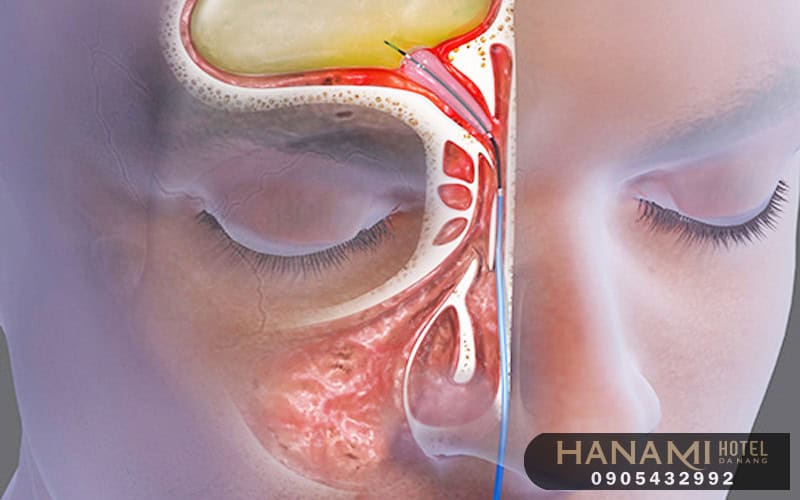 15 phòng khám tai mũi họng uy tín tại Đà Nẵng 13 tai mui hong 1