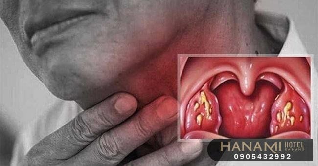 15 phòng khám tai mũi họng uy tín tại Đà Nẵng 8 tai mui hong 3 1