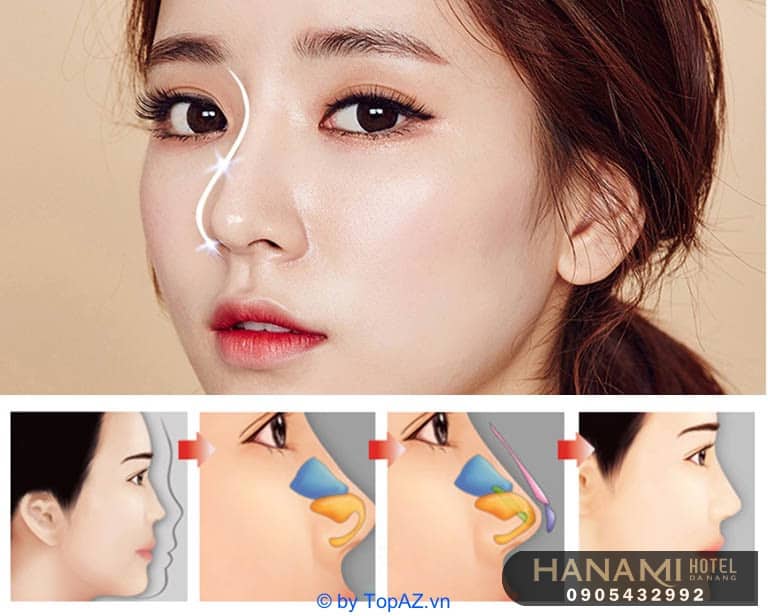 địa chỉ nâng mũi Đà Nẵng