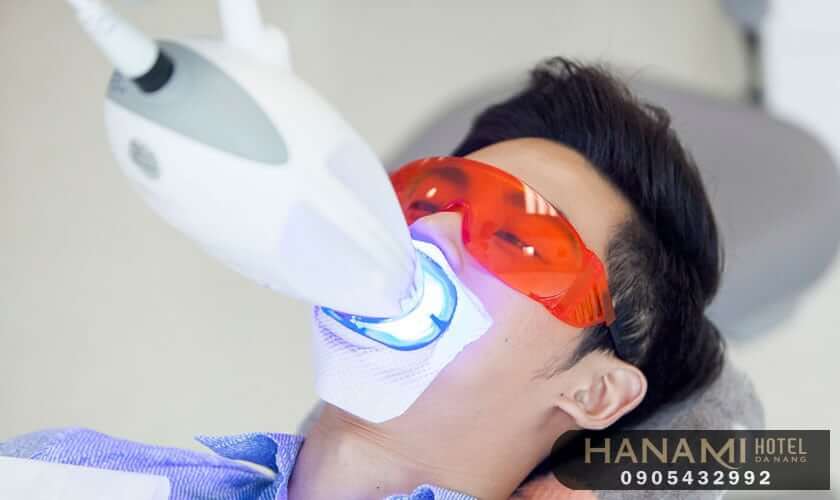 Top 15 best addresses for teeth whitening in Da Nang, reviews by Hanami 7 teeth whitening in da nang
