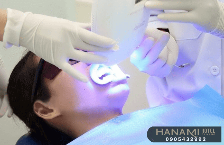 teeth whitening in da nang