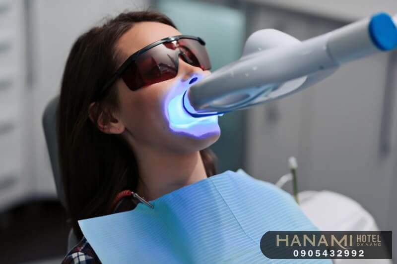 Top 15 best addresses for teeth whitening in Da Nang, reviews by Hanami 5 teeth whitening in da nang