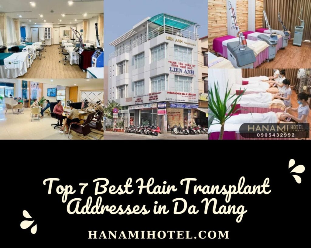 Best hair transplant addresses in Da Nang