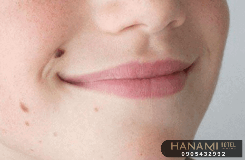 best places for mole remover in da nang