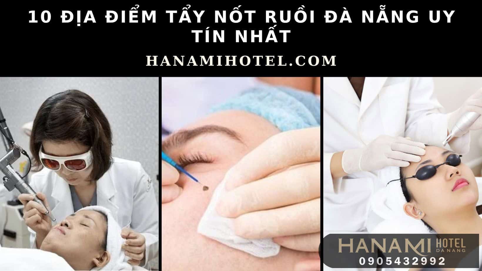 địa điểm tẩy nốt ruồi Đà Nẵng