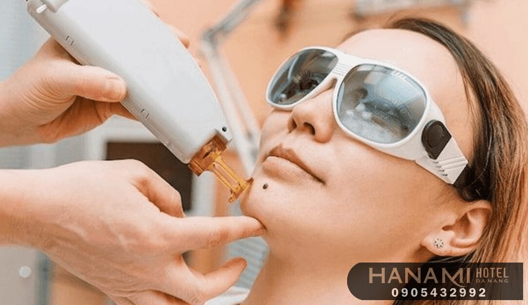 10 địa điểm tẩy nốt ruồi Đà Nẵng uy tín nhất 9 tẩy nốt ruồi đà nẵng