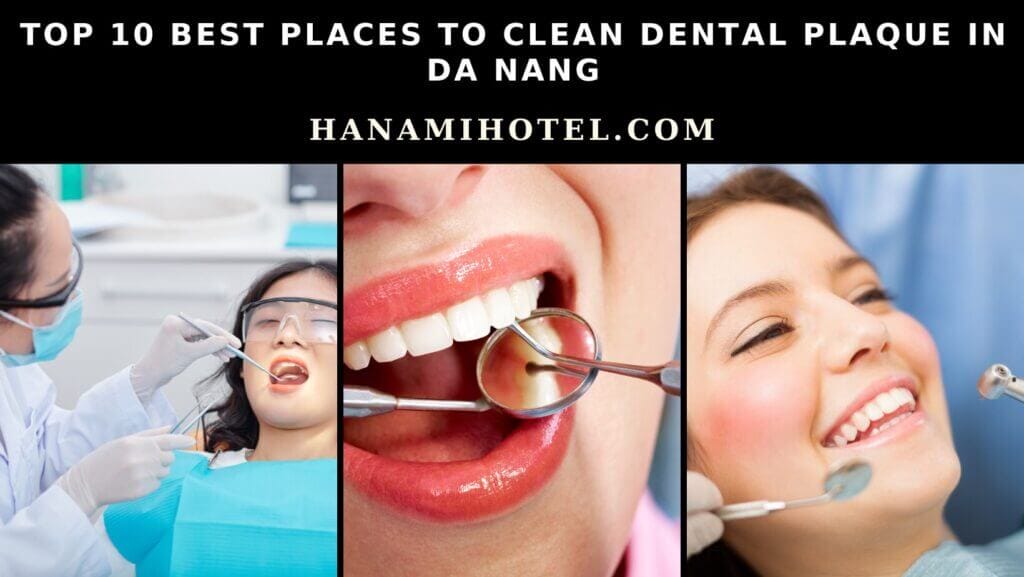 best places to clean dental plaque in da nang