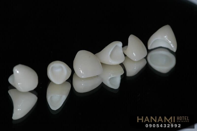 bọc răng sứ ở Đà Nẵng