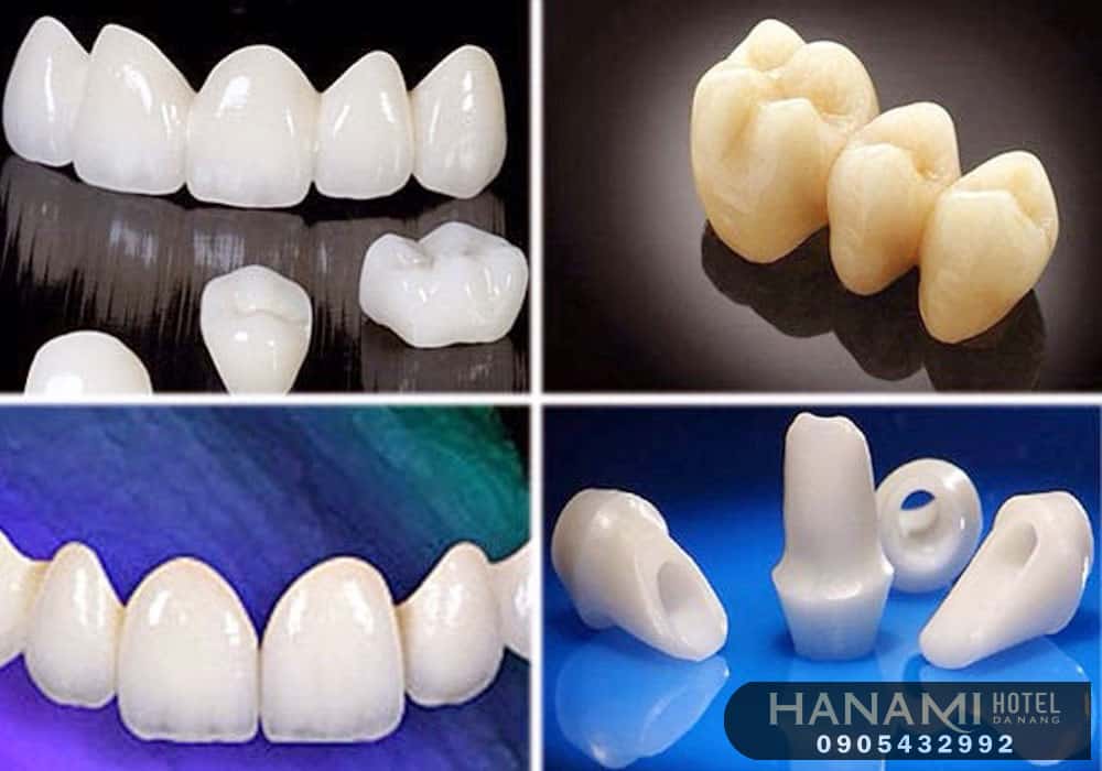 bọc răng sứ ở Đà Nẵng