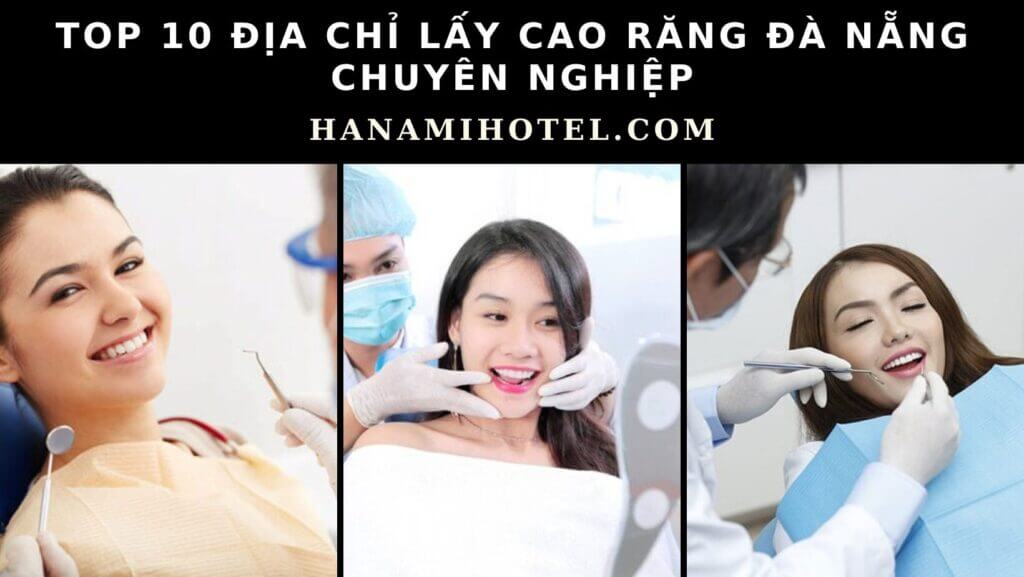 Địa chỉ lấy cao răng Đà Nẵng