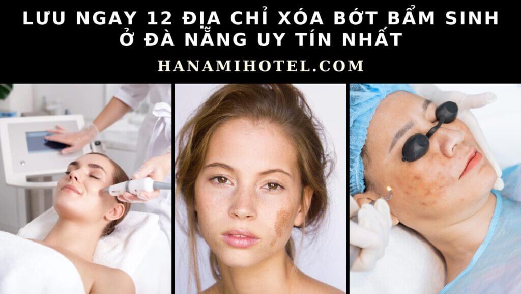 xóa bớt bẩm sinh ở Đà Nẵng