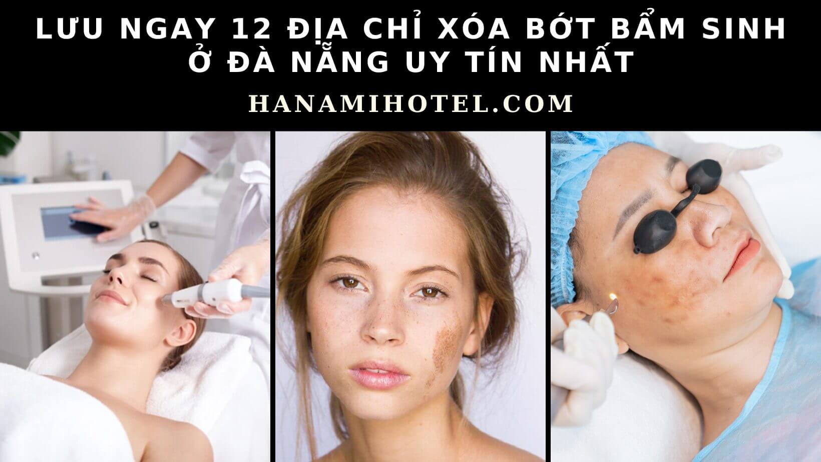 xóa bớt bẩm sinh ở Đà Nẵng